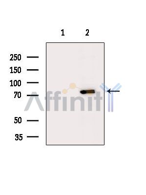 TNS4 Antibody - Western blot analysis of extracts from Hela cells(heat-shock treatment), using TNS4 Antibody.