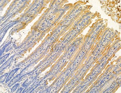 B4GALNT3 Antibody - DF14732 at 1/100 staining rat colorectal tissue by IHC-P.