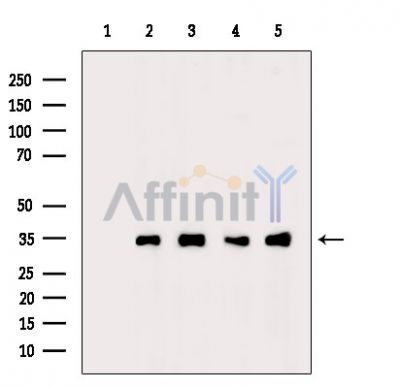 DDAH1 Antibody - Western blot analysis of extracts from various samples, using DDAH1 Antibody.