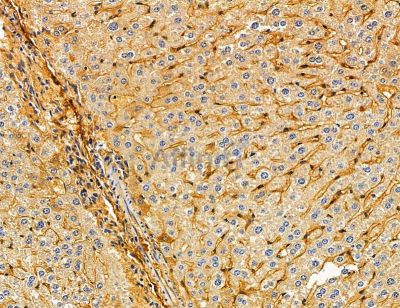 MTX2 Antibody - DF14737 at 1/100 staining mouse liver tissue by IHC-P.