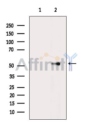 SLC41A1 Antibody - Western blot analysis of extracts from Rat brain, using SLC41A1 Antibody.