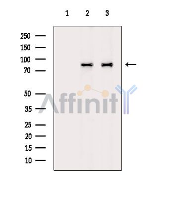 ADARB2 Antibody - Western blot analysis of extracts from various samples, using ADARB2 Antibody.