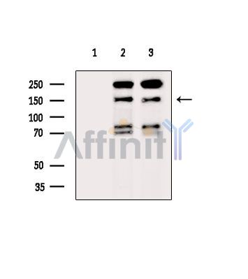 RPRD2 Antibody - Western blot analysis of extracts from various samples, using RPRD2 Antibody.
