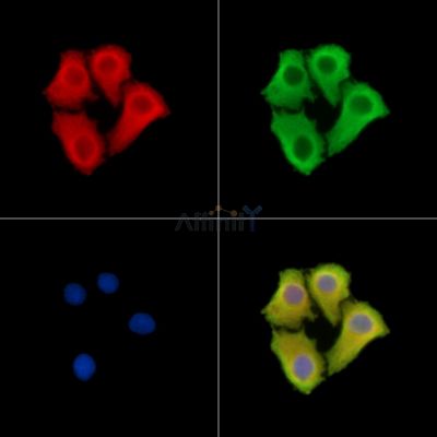 RPRD2 Antibody - DF14744 staining Hela cells by IF/ICC.