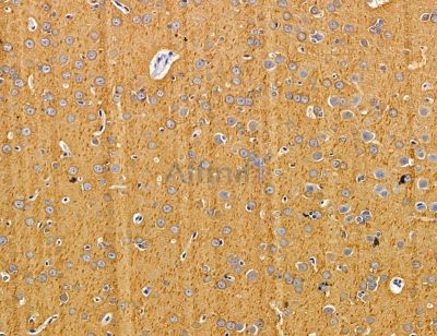 PARP16 Antibody - DF14758 at 1/100 staining rat brain tissue by IHC-P.