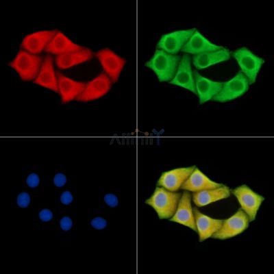 PARP16 Antibody - DF14758 staining Hela cells by IF/ICC.
