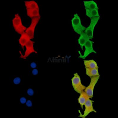 SIDT2 Antibody - DF14770 staining Hela cells by IF/ICC.