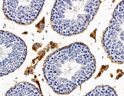 ABCB9 Antibody - DF14774 at 1/100 staining mouse testis tissue by IHC-P.