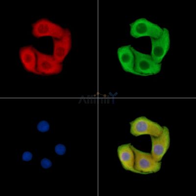 ABCB9 Antibody - DF14774 staining Hela cells by IF/ICC.
