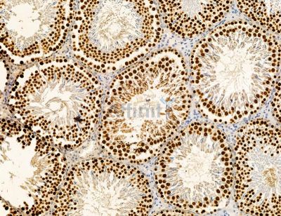 GRHL2 Antibody - DF14779 at 1/100 staining rat testis tissue by IHC-P.