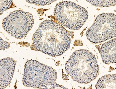 TRIM67 Antibody - DF14783 at 1/100 staining mouse testis tissue by IHC-P.