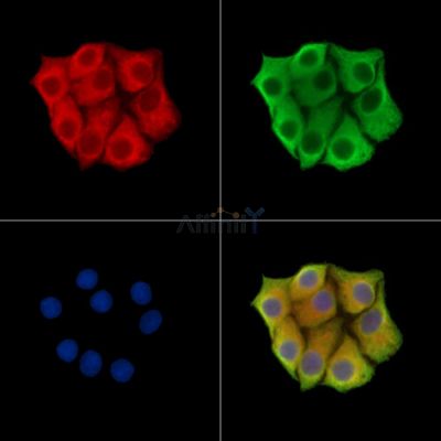 TRIM67 Antibody - DF14783 staining Hela cells by IF/ICC.