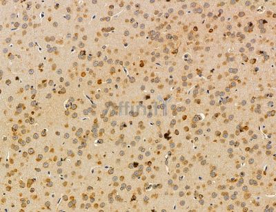 FSIP1 Antibody - DF14788 at 1/100 staining rat brain tissue by IHC-P.