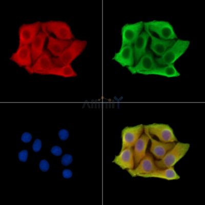 FSIP1 Antibody - DF14788 staining Hela cells by IF/ICC.