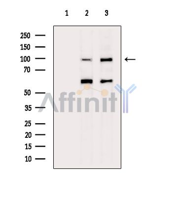 PAN3 Antibody - Western blot analysis of extracts from various samples, using PAN3 Antibody.