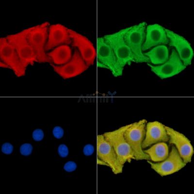PAN3 Antibody - DF14792 staining Hela cells by IF/ICC.