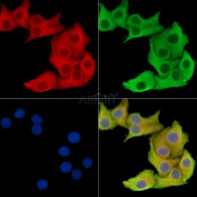 FAM71D Antibody - DF14798 staining Hela cells by IF/ICC.