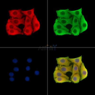 NRROS Antibody - DF14800 staining Hela cells by IF/ICC.