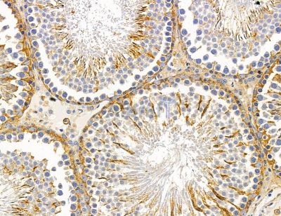 CCSER1 Antibody - DF14803 at 1/100 staining rat testis tissue by IHC-P.