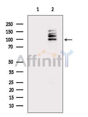 DSC2 Antibody - Western blot analysis of extracts from Hela cells(heat-shock treatment), using DSC2 Antibody.