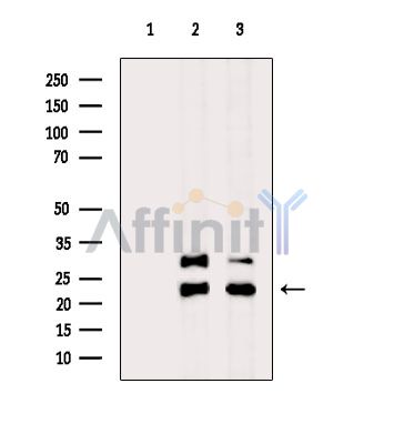 TMED2 Antibody - Western blot analysis of extracts from various samples, using TMED2 Antibody.