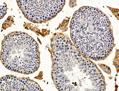 TMED2 Antibody - DF14862 at 1/100 staining mouse testis tissue by IHC-P.
