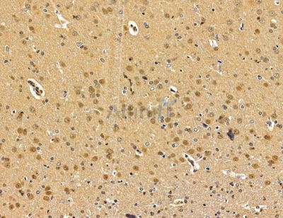 CMAS Antibody - DF14864 at 1/100 staining rat brain tissue by IHC-P.