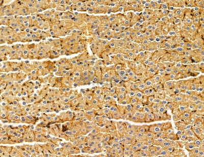 ZPBP Antibody - DF14866 at 1/100 staining mouse liver tissue by IHC-P.