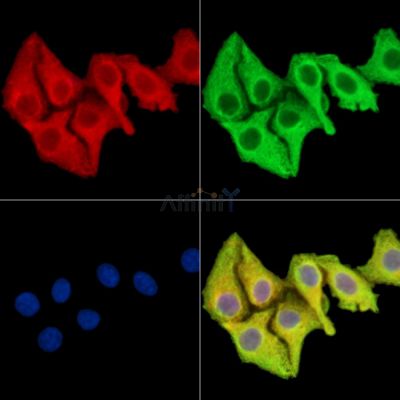 ZPBP Antibody - DF14866 staining Hela cells by IF/ICC.