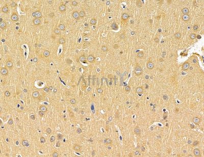 CCDC170 Antibody - DF14869 at 1/100 staining rat brain tissue by IHC-P.