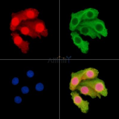 CCDC170 Antibody - DF14869 staining Hela cells by IF/ICC.