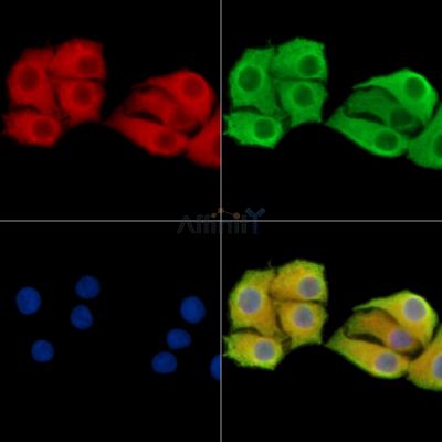 CCDC68 Antibody - DF14870 staining Hela cells by IF/ICC.