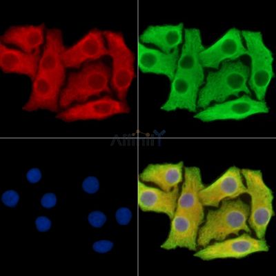 SLC25A33 Antibody - DF14871 staining Hela cells by IF/ICC.