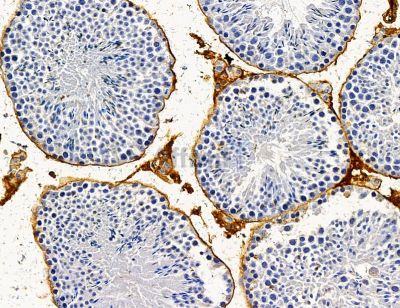 TMLHE Antibody - DF14872 at 1/100 staining mouse testis tissue by IHC-P.
