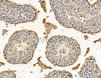 BCL2L15 Antibody - DF14875 at 1/100 staining mouse testis tissue by IHC-P.