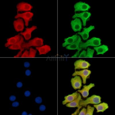 UNC13B Antibody - DF14879 staining Hela cells by IF/ICC.