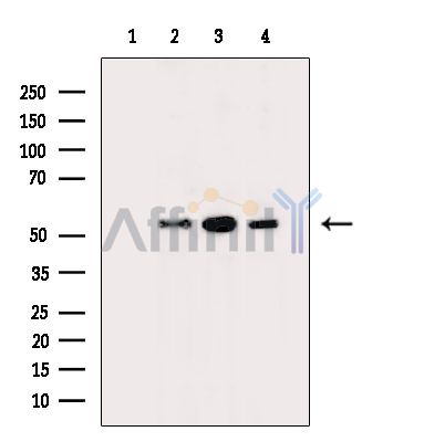 RTCB Antibody - Western blot analysis of extracts from various samples, using RTCB Antibody.