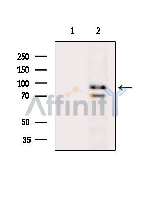 ZC3H12C Antibody - Western blot analysis of extracts from Mouse brain, using ZC3H12C Antibody.