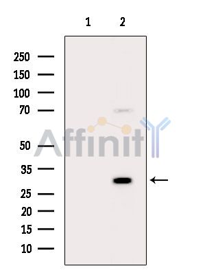 UTP11 Antibody - Western blot analysis of extracts from Hela cells(heat-shock treatment), using UTP11 Antibody.