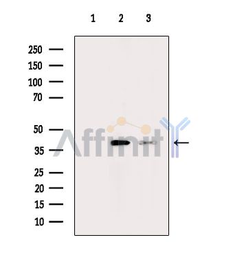 DPH1 Antibody - Western blot analysis of extracts from various samples, using DPH1 Antibody.