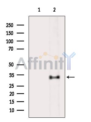 NOSIP Antibody - Western blot analysis of extracts from HepG2 cells(heat-shock treatment), using NOSIP Antibody.