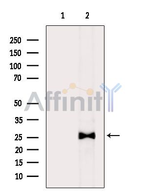 RTP2 Antibody - Western blot analysis of extracts from Rat liver, using RTP2 Antibody.