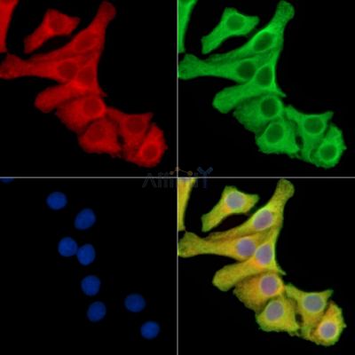ENTPD8 Antibody - DF14941 staining Hela cells by IF/ICC.
