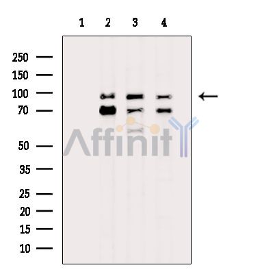 FAM91A1 Antibody - Western blot analysis of extracts from various samples, using FAM91A1 Antibody.