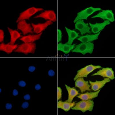 ADAMTSL3 Antibody - DF14949 staining Hela cells by IF/ICC.