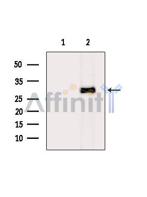 CTDSPL Antibody - Western blot analysis of extracts from Hela cells(heat-shock treatment), using CTDSPL Antibody.