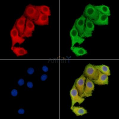 WDR41 Antibody - DF15008 staining Hela cells by IF/ICC.