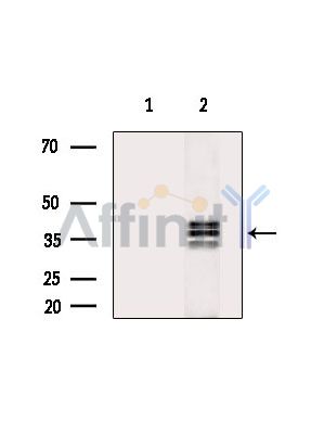 DTX3 Antibody - Western blot analysis of extracts from Hela cells(heat-shock treatment), using DTX3 Antibody.