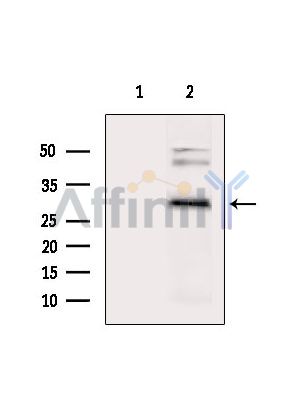 SLC39A3 Antibody - Western blot analysis of extracts from Hela cells(heat-shock treatment), using SLC39A3 Antibody.