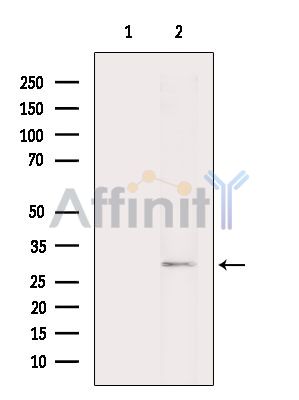ZNF444 Antibody - Western blot analysis of extracts from Mouse brain, using ZNF444 Antibody.